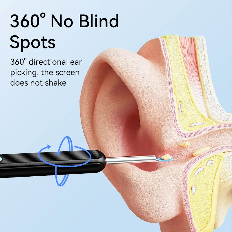 Smart Ear Wax Cleaner with HD Camera
