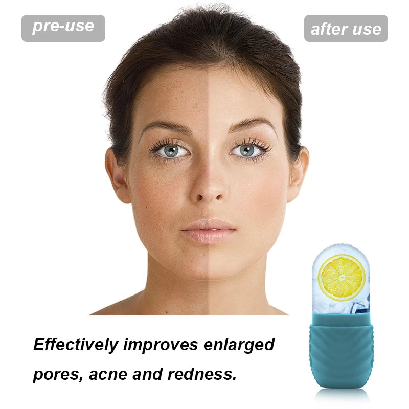 Ice Roller for Face β Reusable Silicone Beauty Tool